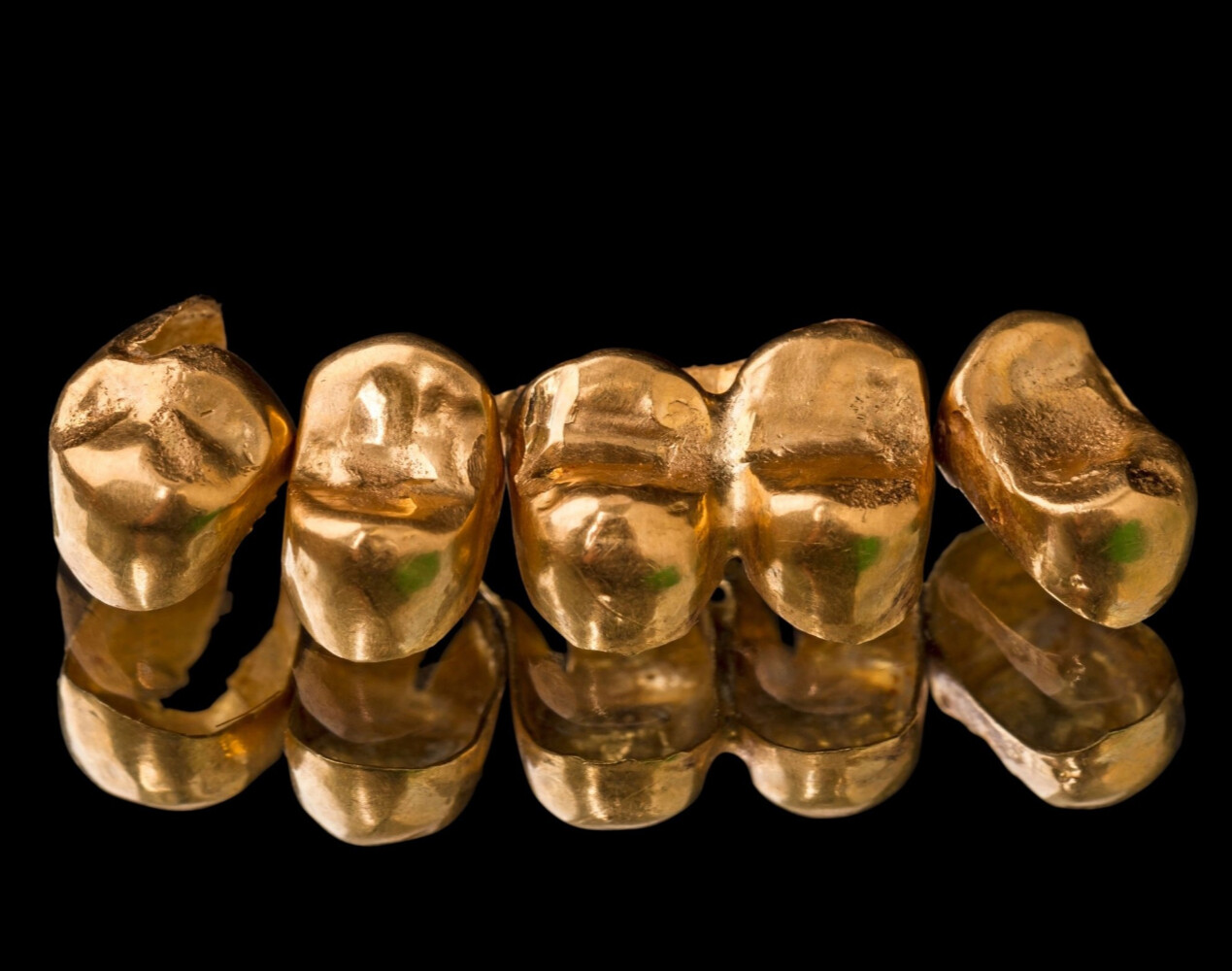 Скупка  стоматологического золота в Екатеринбурге
